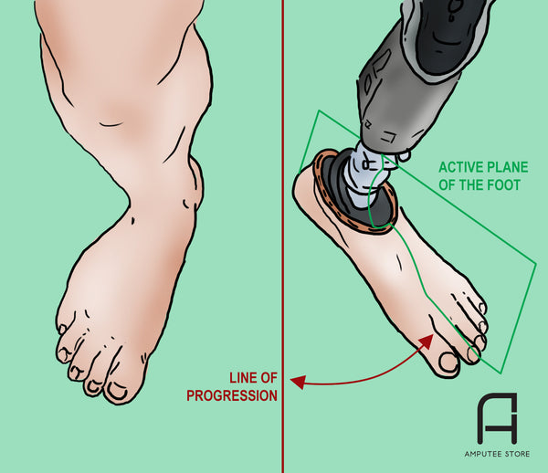 Prosthetic foot rotation baseline