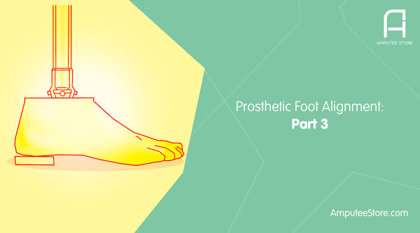 Rotational alignment of your prosthetic foot is critical in preventing whips.