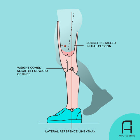 An illustration of a residual limb attached to a below-the-knee prosthetic leg to illustrate the ideal prosthetic socket alignment viewed from front to back.