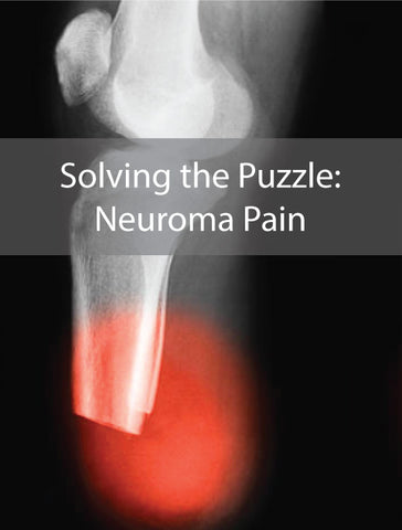 Neuroma pain can be very painful along your stump and prosthesis.