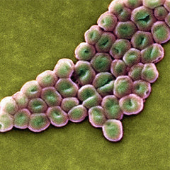 bacteria-en-agua-enfermedades-en-personas-acinobacter