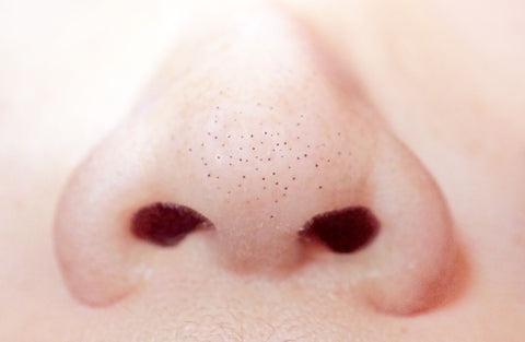 nose blackheads remove pimple blackheads mon cheri