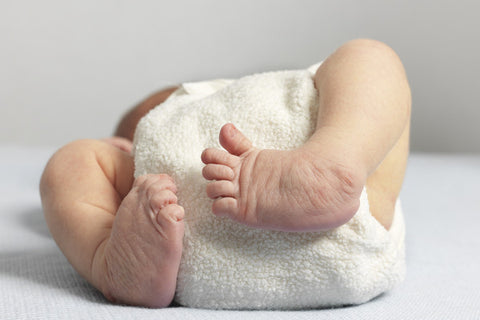 image of an infants feet and legs affected by arthrogryposis multiplex congenita