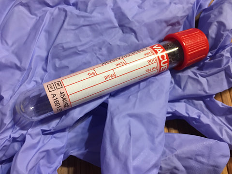 Vial containing blood on top of medical gloves