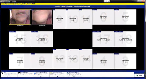 dentimax setting for prodent camera