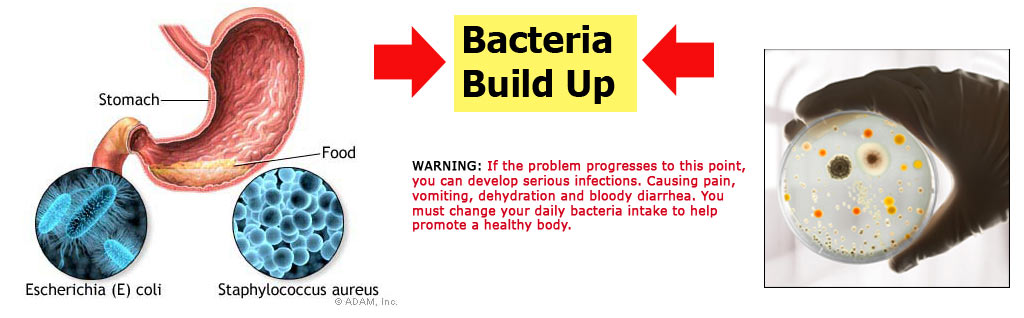 Bacteria Is Very Bad