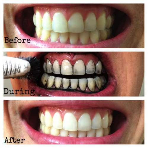 PerfectWhitening Activated Charcoal Natural Teeth Whitener ...