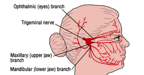 TN nerve, trigeminal neuralgia, trigeminal neuralgia diagram, TN diagram, TN nerve diagram