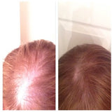 Women's hair loss before & after