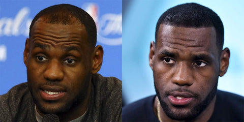 Zenagen LeBron James Hair Loss Before After