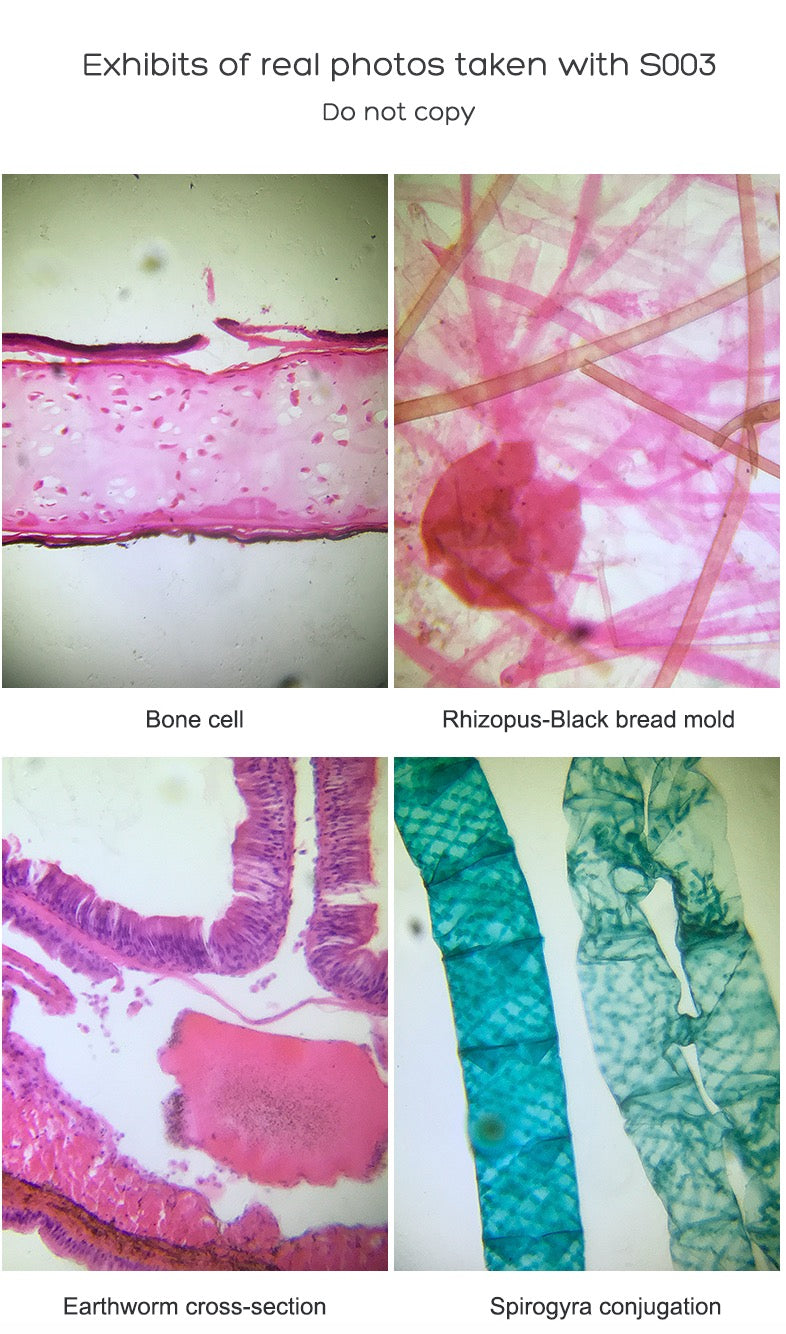 Supereyes S003 Portable Smartphone Biological Microscope for Smart Phones iPhone Samsung Tablets 