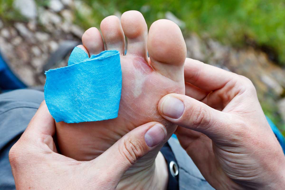 Hiker with sock and shoe off to tend to a blister.