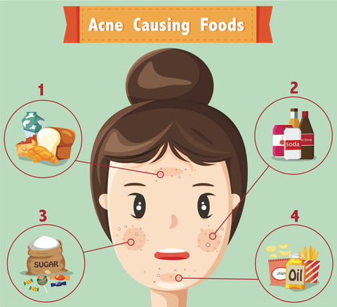 prevent acne