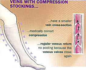 Compression Stockings for Slim Legs – Wink Shapewear