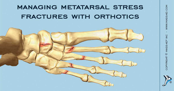 insoles for metatarsal fracture