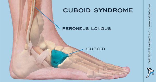 Cuboid Foot