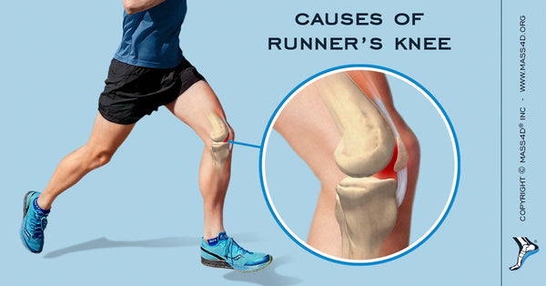 Causes of Runner's Knee - MASS4D® Foot 