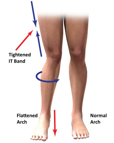 Iliotibial Band Syndrome: Causes and Treatments via Mass4D - www.mass4d.com