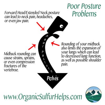 Poor Posture Can Commonly Cause These Problems