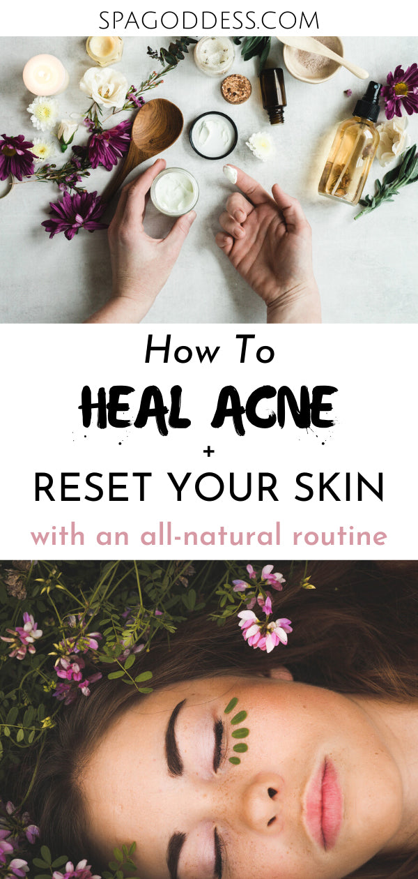 How to Reset Your Skin and Heal Acne Naturally