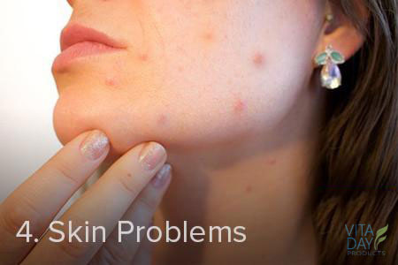 Detox Can Help With Skin Problems