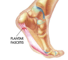 Heel: Three Types of Common Heel Pain 