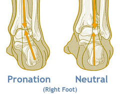 insoles to stop foot rolling inwards