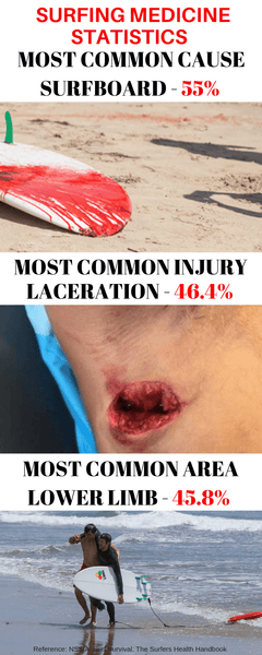 Paddleboarding Injury Statistics