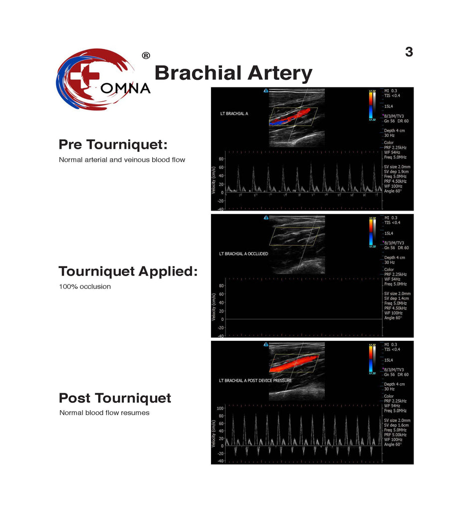 OMNA Tourniquet Surfboard Leash Brachial Arterial Occlusion