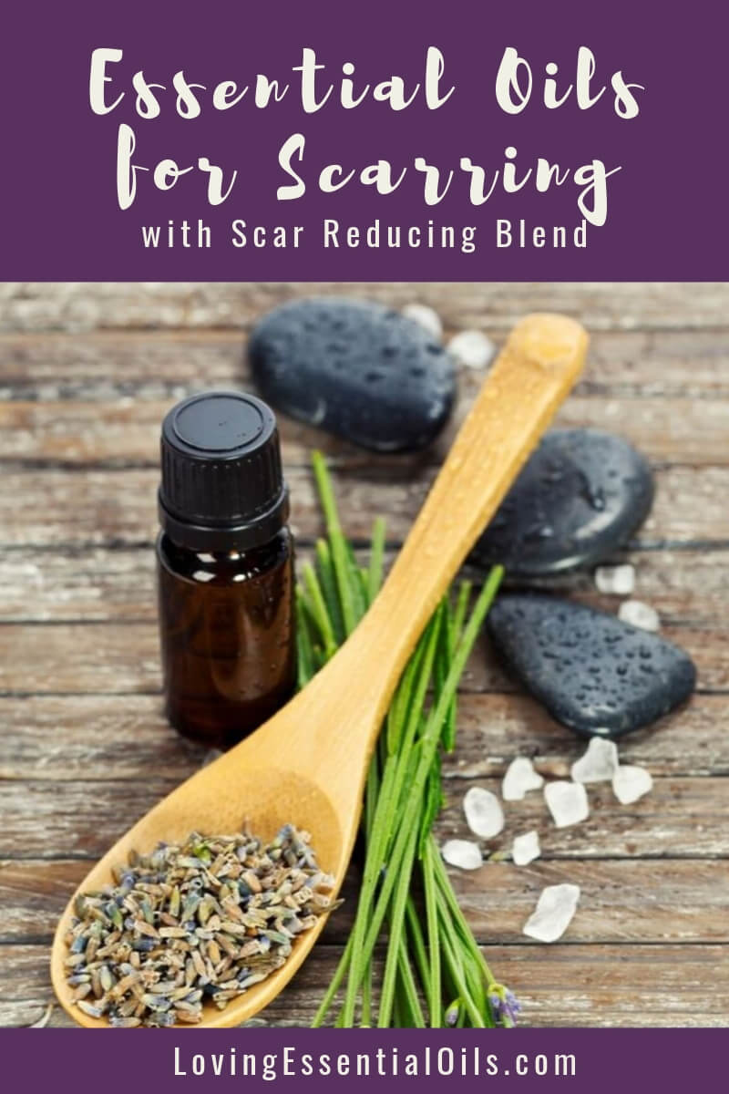 Best Essential Oil for Scars with Scar Reducing Blend by Loving Essential Oils