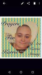 Karris Just After The First Few Chemo Treatments