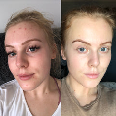 Bravura Skincare before and after