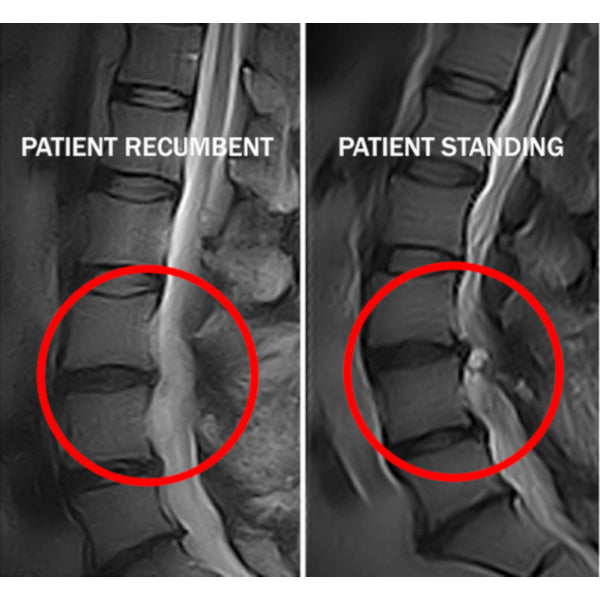 Standing and Weight Bearing X-ray Markers 