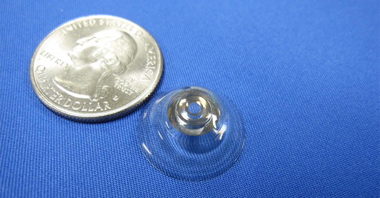 A Future History of Contact Lenses