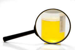 The Estrogen Test that Saves Lives
