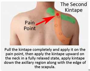 how to kinesiology taping the back pain