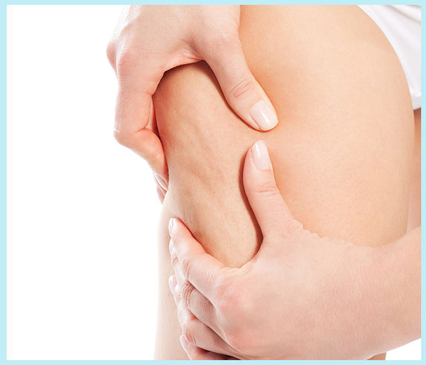 7-Interesting-Facts-About-Cellulite-You-Should-Be-Aware-Of