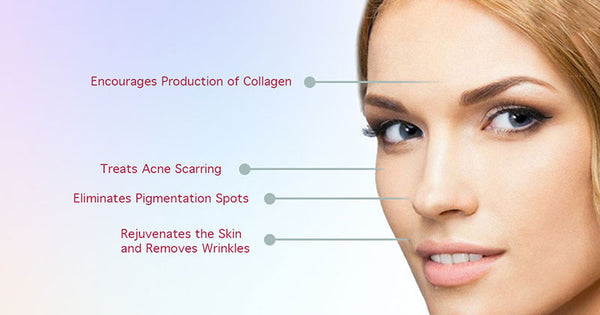 Benefits Of Microneedling