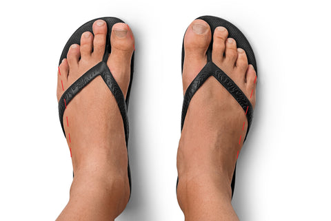 Archies Arch Support Thongs Flip Flops Top view of overhang