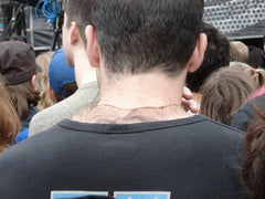 neck hair