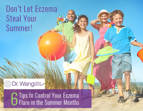 tips to Prevent Eczema Flare in the summer