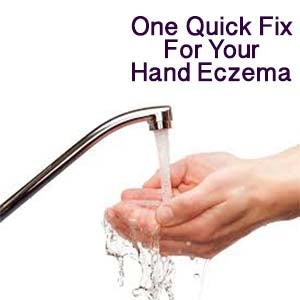 Common cause for Hand eczema 