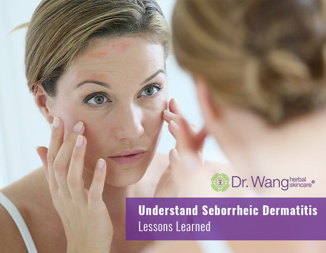 Understand Seborrheic Dermatitis - Lessons Learned