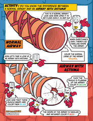 What is Asthma?