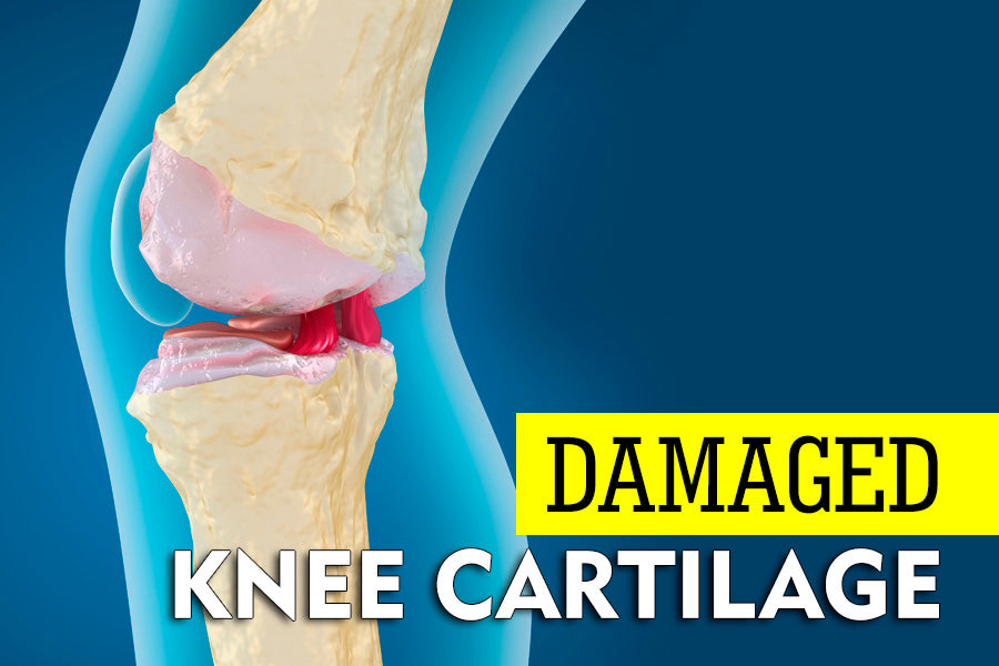 Exercises for Damaged Knee Cartilage