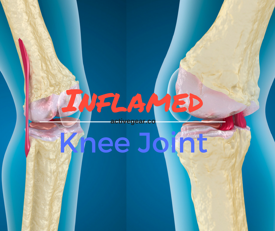 Dietary Tips for Inflamed Joints