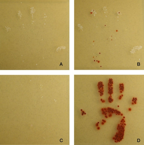 bacteria from contaminated hands