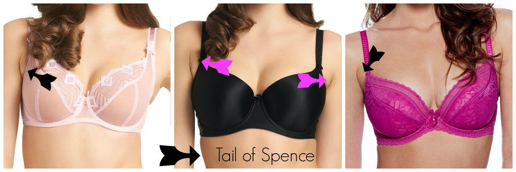 Is Bra Fat (Armpit Fat/axillary fat) caused by tight bras?