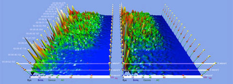 brainwave EEG frontal lobes - Sacred Acoustics