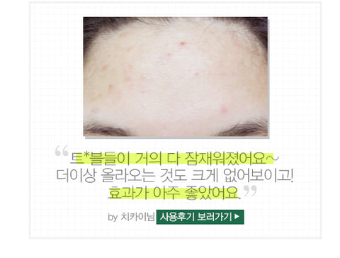 Aromatica – Tea Tree 53 Blemish Spot